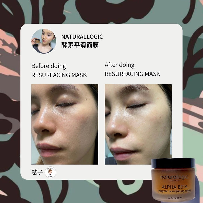 Naturallogic Alpha Beta Enzyme Resurfacing Mask 酵素平滑面膜(60ml)
