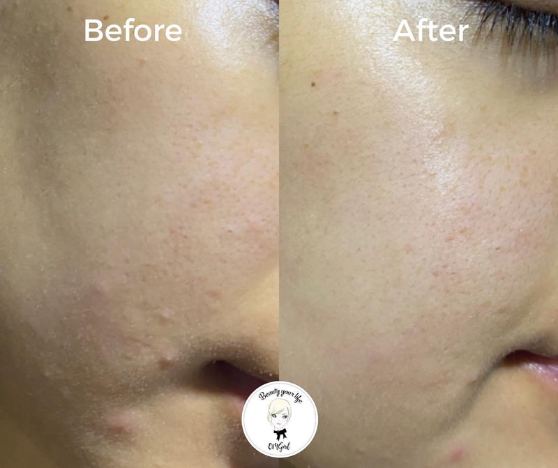 Aika Wellness Herbal Detox Mask(30ml)