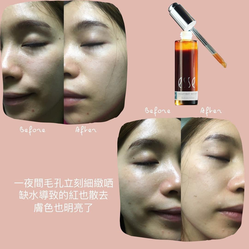 ESSE Resurrect Serum 賦活精華 （30ml）