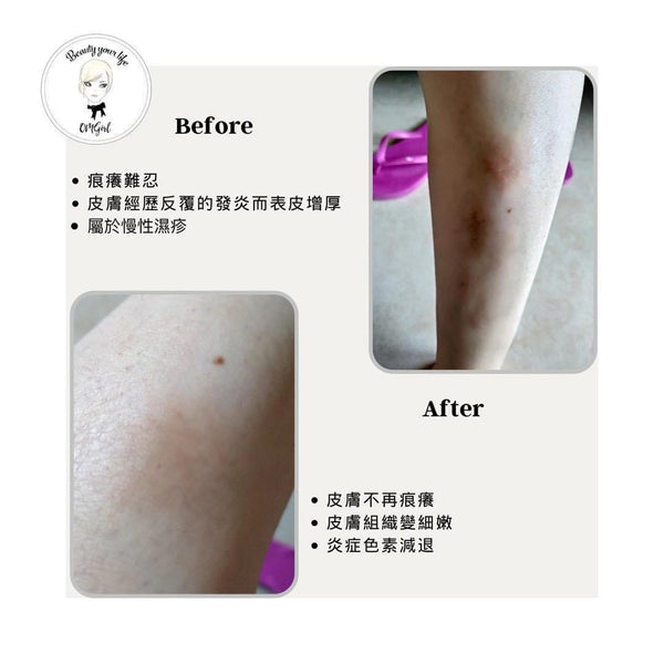 NIPPI COLLAGEN ProHyp PLUS皮膚修護保濕乳液 (280g)